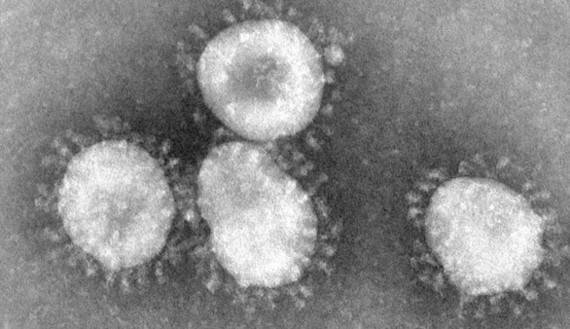 Coronaviruses 004 lores de Photo Credit:Content Providers(s): CDC/Dr. Fred Murphy - This media comes from the Centers for Disease Control and Prevention