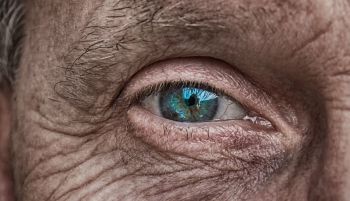 Científicos españoles identifican la proteína clave en el envejecimiento de la piel