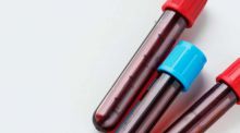 El análisis de ciertas proteínas en la sangre permite predecir qué órganos fallarán antes