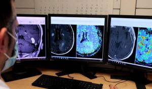 Una nueva herramienta basada en la IA mejorará el diagnóstico de cáncer cerebral