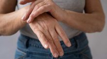 Artritis psoriásica: nuevas recomendaciones para su tratamiento
