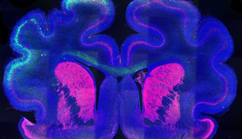 Descubren el posible mecanismo que produce los pliegues en la corteza cerebral