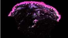 El primer mapa de la piel humana potenciará la medicina regenerativa