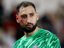 La patada de un jugador del Mónaco que dejó a Donnarumma con la cara en este estado