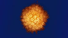 Sorpresa al vincular el herpes con el mal de Alzheimer