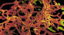 El virus del Ébola se transmite también por la piel