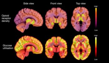 Localizan una posible causa de la anorexia nerviosa