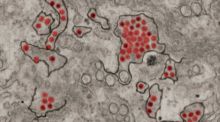 El virus Zika paraliza las células para evitar al sistema inmune