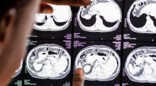 Nuevo enfoque para tratar la lesión cerebral traumática