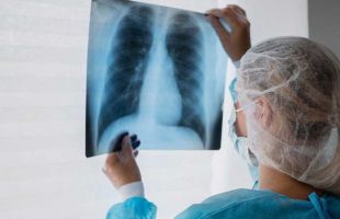 Los tumores fueron la primera causa de muerte en 2024