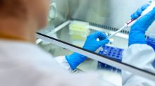 Déficit de hierro y enfermedad de Crohn