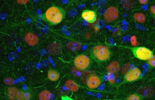 Un grupo de neuronas de la amígdala podría estar detrás de la ansiedad