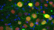 Un grupo de neuronas de la amígdala podría estar detrás de la ansiedad