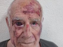 Un grupo de magrebíes da una brutal paliza por diversión a un hombre de 70 años en Torre-Pacheco