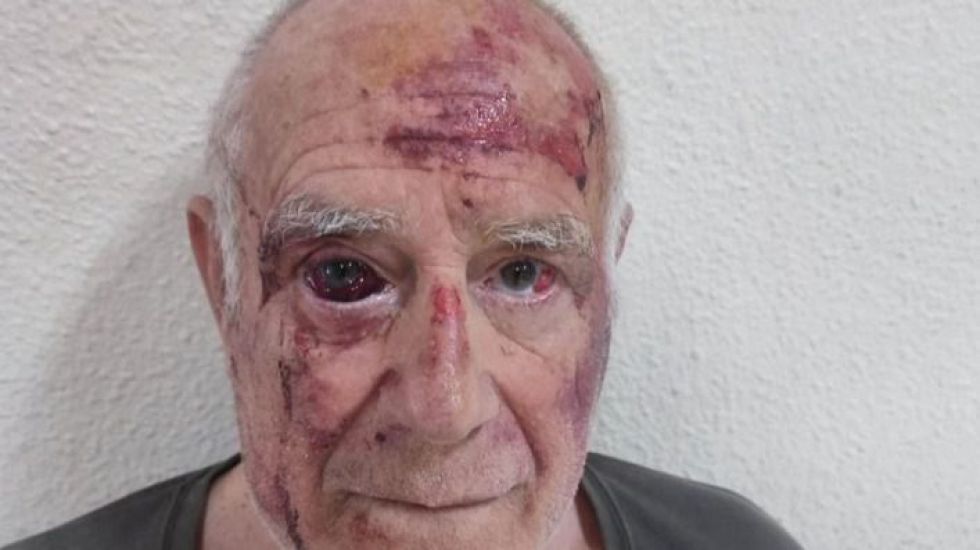 Un grupo de magrebíes da una brutal paliza por diversión a un hombre de 70 años en Torre-Pacheco
