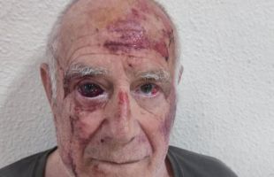 Un grupo de magrebíes da una brutal paliza por diversión a un hombre de 70 años en Torre-Pacheco