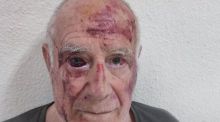 Un grupo de magrebíes da una brutal paliza por diversión a un hombre de 70 años en Torre-Pacheco