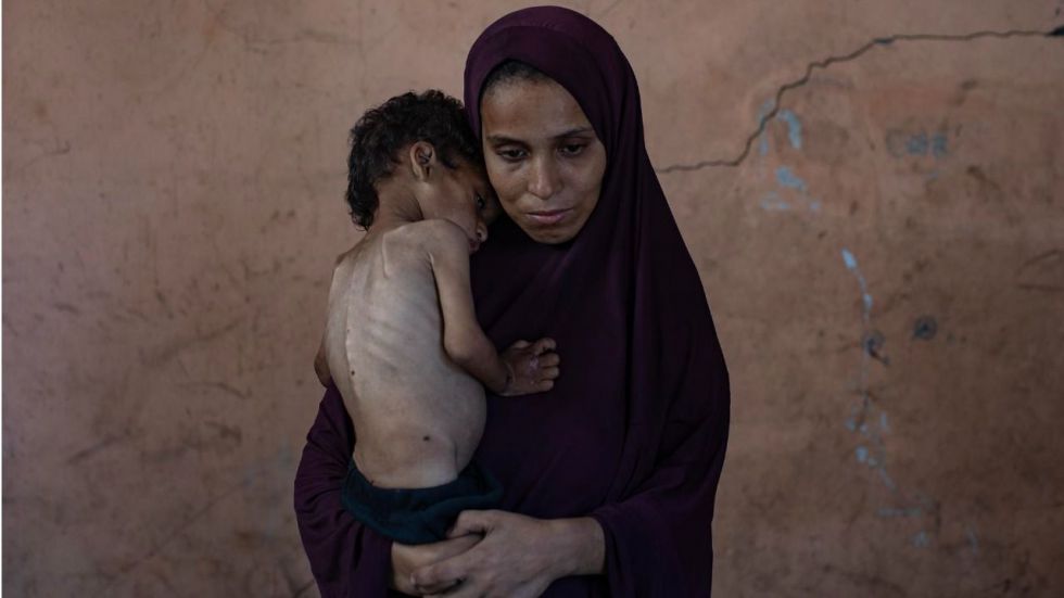 La ONU denuncia que Israel está matando de hambre a los gazatíes