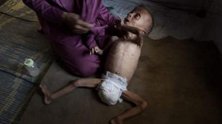 Israel anuncia una 'pausa táctica' diaria para permitir el reparto de ayuda humanitaria en Gaza