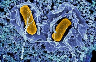 Siete ingreasados y más de 400 afectados por el brote de salmonelosis en Barbastro (Huesca)