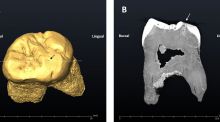 Desvelan que los neandertales utilizaban su dentadura como 'una tercera mano'