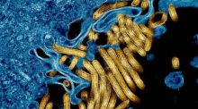 Descubren una molécula que bloquea al virus del Ébola