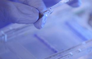 La Fundación La Caixa impulsa 31 proyectos de biomedicina y salud