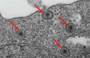 Descubren cómo frenar el rotavirus