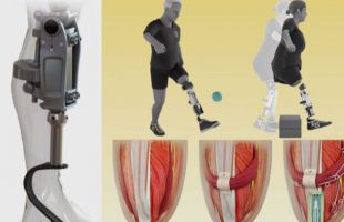 Una rodilla biónica integrada en el tejido restaura el movimiento natural