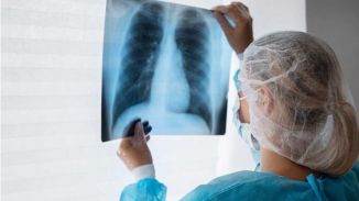 Aumenta el cáncer de pulmón en menores de 50 años: la mayoría son mujeres