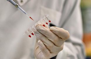 34 proyectos de investigación biomédica reciben 26 millones de la Fundación La Caixa