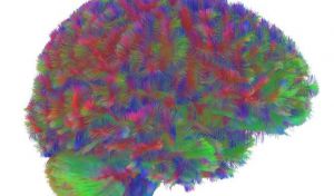 Identifican cinco grandes eras en la arquitectura del cerebro humano a lo largo de la vida