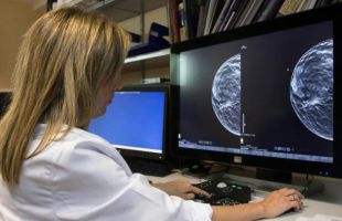 Las mamografías asistidas por inteligencia artificial detectan más tumores