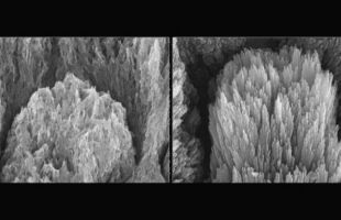 ¿Es posible restaurar el esmalte dental?