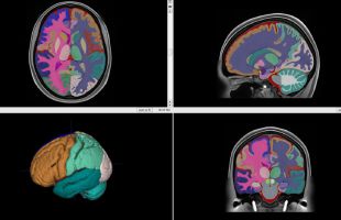 Desarrollan uno de los atlas del cerebro más detallados del mundo