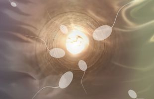 Detectan el primer caso en el mundo de transmisión de una enfermedad rara mediante donante de esperma