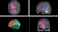 Desarrollan uno de los atlas del cerebro más detallados del mundo