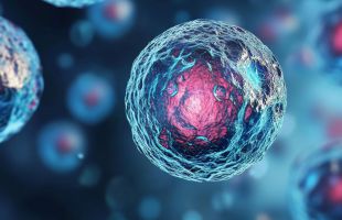 Una paciente supera tres enfermedades autoinmunes gracias a una terapia CAR-T