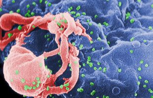 El paciente de Oslo, décimo en curarse del VIH con un trasplante de células madre