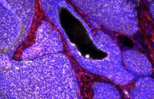 Vinculan por primera vez la exposición a un pesticida desde la infancia con el desarrollo de cáncer de colon en jóvenes