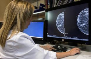 Inteligencia Artificial en los hospitales públicos madrileños para agilizar el diagnóstico de los cánceres de próstata y de mama
