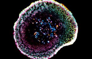 Visualizan por primera vez en 3D cómo el sistema inmune destruye células cancerosas