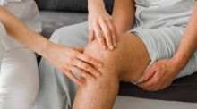 Artritis reumatoide: reducen la inflamación en las articulaciones