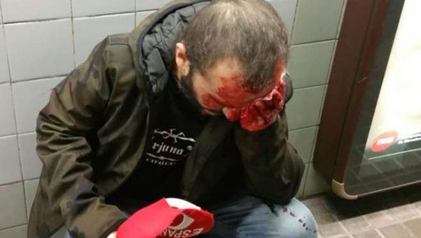 Al grito de 'muera España', fue empujado sin previo aviso por las escaleras del metro.